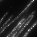 View the 'Dynamics of early endosomes in hyphal cells' movie