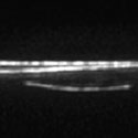 View the 'Microtubule organisation in a hyphal cell' movie