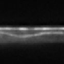 View the 'Microtubule dynamics in a hyphal cell' movie