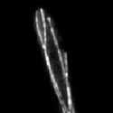 View the 'Microtubule organisation in a yeast-like cell' movie