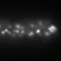 View the 'Dynamics of F-actin patches at the tip of a hyphal cell' movie